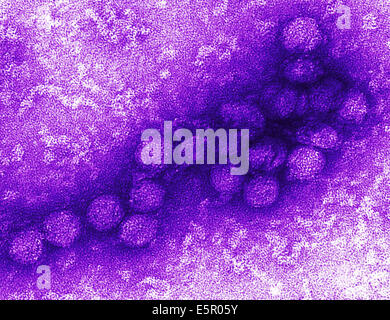 Micrografia elettronica del virus del Nilo occidentale, questo virus di RNA è un flavivirus (flaviviridae) responsabile per la febbre del Nilo occidentale. Foto Stock