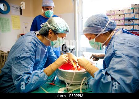 Rimozione parziale di un fegato da un donatore vivente per laparoscopia per un trapianto, qui, preparazione di innesto, Dipartimento di Foto Stock