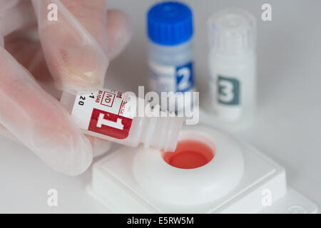 Test HIV rapido. Foto Stock