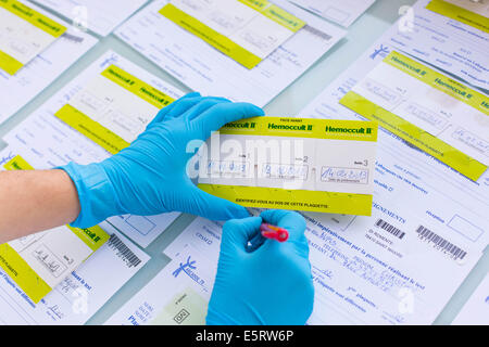 Hemoccult test in laboratorio. Foto Stock