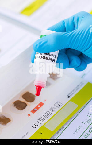 Hemoccult test in laboratorio. Foto Stock