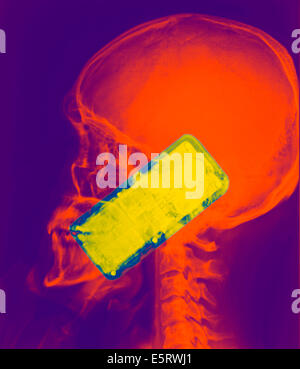 Colorato X-ray che mostra la testa di un uomo utilizzando uno smartphone. L'uso del telefono cellulare genera microonde che penetrano nel Foto Stock