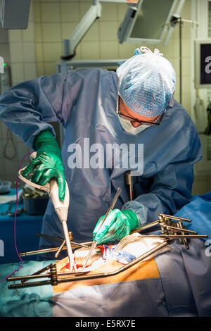 Cistectomia, la rimozione di un cancro della vescica, Diaconesses ospedale, Paris, Francia. Foto Stock