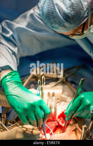 Cistectomia, la rimozione di un cancro della vescica, Diaconesses ospedale, Paris, Francia. Foto Stock