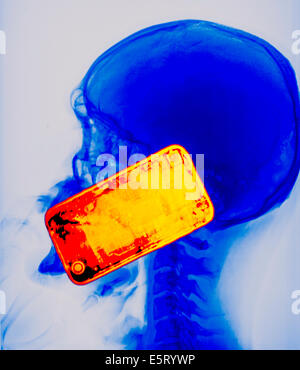 Colorato X-ray che mostra la testa di un uomo utilizzando uno smartphone. L'uso del telefono cellulare genera microonde che penetrano nel Foto Stock