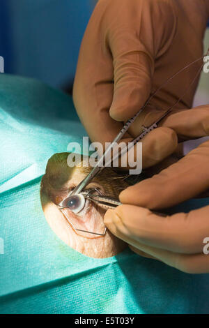 Chirurgo rimuovendo la cornea da donatore. La cornea saranno cryostored e utilizzato per il trapianto Angoulême ospedale, Francia. Foto Stock