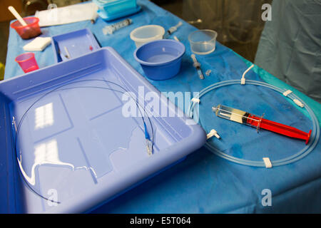 Trattamento di leiomioma uterino da embolizzazione, Hopital Europeen Georges Pompidou (HEGP), AP-HP, Parigi, Francia. Foto Stock