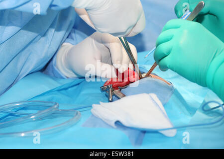 L'enfisema polmonare chirurgia su un 4 mesi old boy in camera operativa Foto Stock