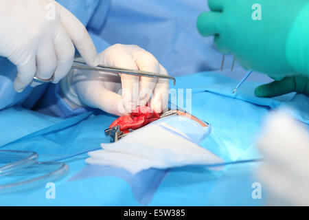Chirurgia su di un polmone di un neonato Foto Stock