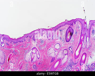 H&E macchia, la microscopia ottica, pelle normale del cuoio capelluto Foto Stock