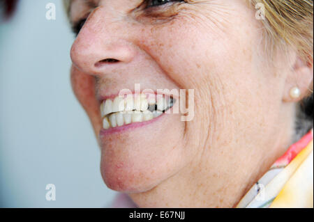 Donna sorridente che mostra la rottura di un dente anteriore Foto Stock