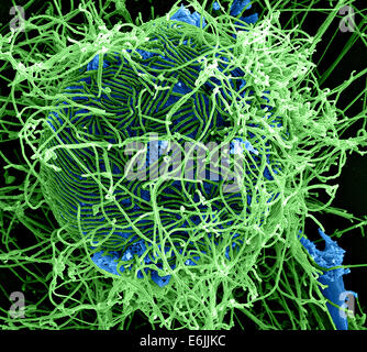 Vista microscopica del virus Ebola. Colorati scanning electron microfotografia di filamentosi virus Ebola particelle attaccate a e nascenti da una cronicamente infette VERO E6 cell. Foto Stock