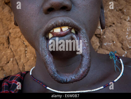 Tribù dei Mursi donna senza piastra a labbro, grandine Wuha Village, Etiopia Foto Stock