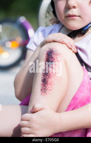 Ragazza giovane azienda gamba ferita, close up Foto Stock