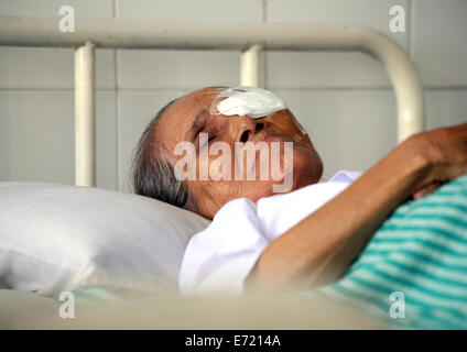 Yangon, Myanmar. 4 Sep, 2014. Un paziente indossa un occhio patch dopo la chirurgia di Yangon, Myanmar, Sett. 4, 2014. Un Cinese team medico ha iniziato un occhio libero il trattamento chirurgico campagna in Yangon giovedì come la terza di questo genere di 'Luminosità' azione nel paese. Credito: U Aung/Xinhua/Alamy Live News Foto Stock