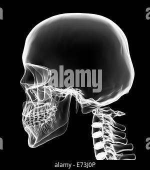 X-ray della testa e del collo in luminosità bianco con sfondo nero Foto Stock