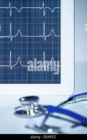 Stetoscopio acustico e elettrocardiogramma (tracciato del polso) visualizzato su una tavoletta digitale schermo Foto Stock