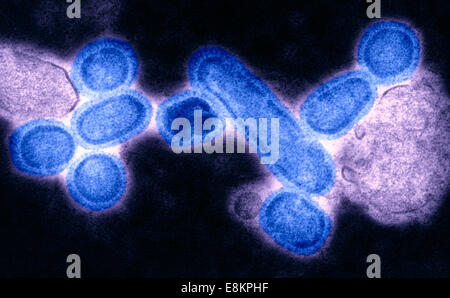 Questo colorato colorato negativo microscopio elettronico a trasmissione (TEM) mostrava ricreato 1918 virioni influenzali che sono stati Foto Stock