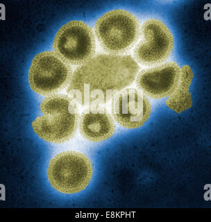 Questo negativo colorizzato macchiate di microscopio elettronico a trasmissione (TEM) illustra i dettagli ultrastrutturali del numero di influenza Foto Stock