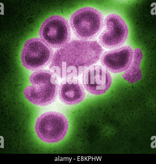 Questo negativo colorizzato macchiate di microscopio elettronico a trasmissione (TEM) illustra i dettagli ultrastrutturali del numero di influenza Foto Stock