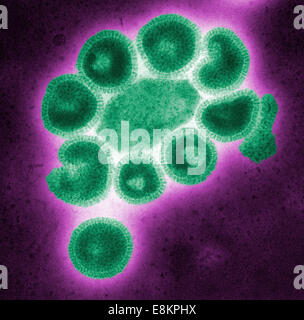 Questo negativo colorizzato macchiate di microscopio elettronico a trasmissione (TEM) illustra i dettagli ultrastrutturali del numero di influenza Foto Stock