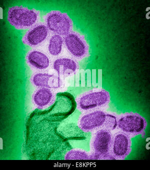 Questo colorato colorato negativo microscopio elettronico a trasmissione (TEM) mostra ricreato 1918 virioni influenzali che sono stati Foto Stock