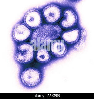 Questo negativo colorizzato macchiate di microscopio elettronico a trasmissione (TEM) illustra i dettagli ultrastrutturali del numero di influenza Foto Stock