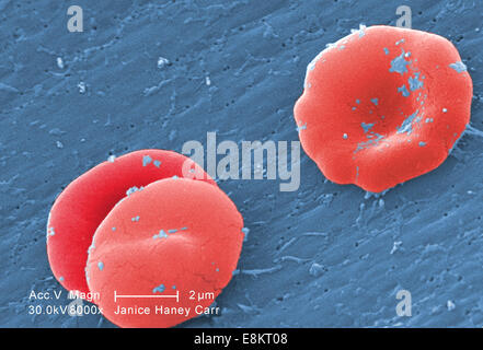 Sotto un elevato ingrandimento di 8000X, questo scanning electron microfotografia (SEM) ha rivelato alcuni di morfologia ultrastrutturale Foto Stock