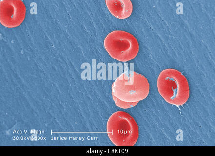 Questo formato digitale-colorati scanning electron microfotografia (SEM) ha rivelato alcuni di morfologia ultrastrutturale visualizzati dal rosso sangue Foto Stock