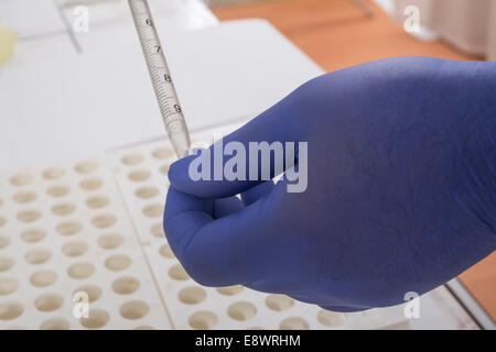 Vera e propria analisi del sangue - Nessuna finzione Foto Stock