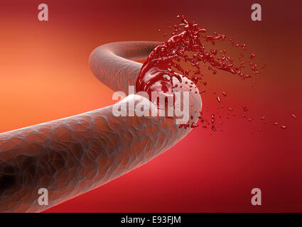 Vena arteria taglio rottura sangue di spurgo Foto Stock