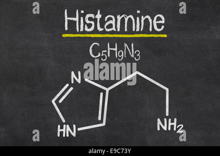 Lavagna con la formula chimica di istamina Foto Stock