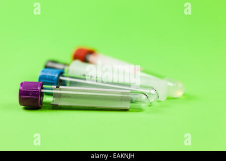 Tubi a vuoto per la raccolta di campioni di sangue in laboratorio Foto Stock