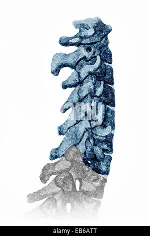 VERTEBRA CERVICALE, illustrazione Foto Stock