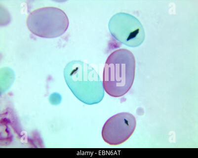 Patata (solanum tuberosum), immagine microscopica della fecola di patate grani, 1000 x Foto Stock