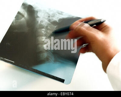 La mano di un medico con la radiografia del collo il disco diviso Foto Stock