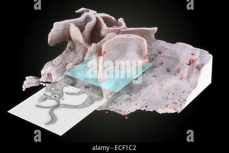 Rappresentazione 3D della superficie e all'interno di un infetti da HIV macrofago ottenuto utilizzando nuovi strumenti sviluppati per imaging 3D Foto Stock