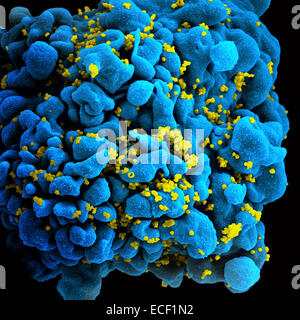 Immagine colorato di infetti da HIV H9 T-cell. Foto Stock