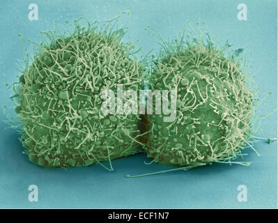 Micrografia elettronica a scansione di appena diviso in cellule HeLa. Zeiss HR Merlin-SEM. Foto Stock