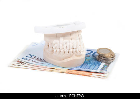 Una serie di denti per la produzione di una protesi dentale, prima che venga il denaro Foto Stock