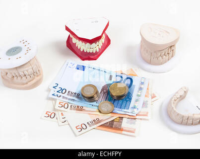 Una serie di denti per la produzione di una protesi dentale, prima che venga il denaro Foto Stock