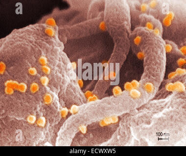 Micrografia elettronica a scansione di HIV. Foto Stock