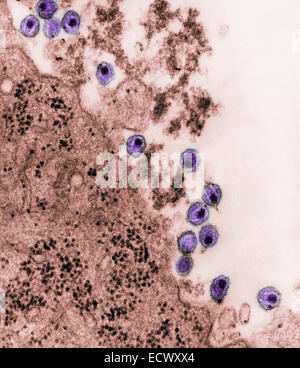 Micrografia elettronica di virus di immunodeficienza umana HIV. Foto Stock