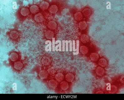 Micrografia elettronica di adenovirus canino tipo-1 (CAV-1). Foto Stock