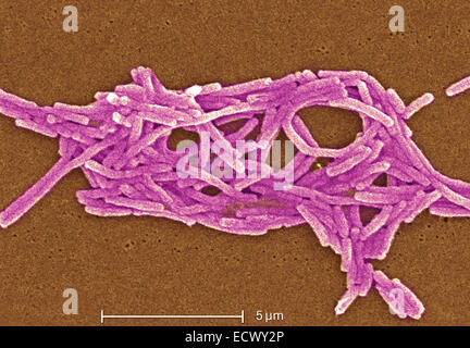 Micrografia elettronica a scansione della Legionella. Foto Stock