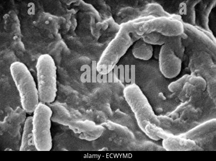 Micrografia elettronica a scansione di Pseudomonas aeruginosa. Foto Stock