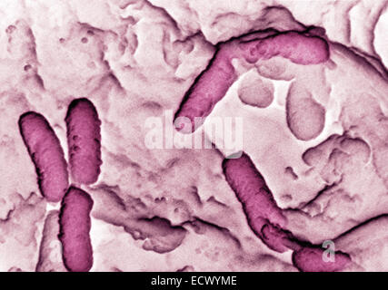 Micrografia elettronica a scansione di Pseudomonas aeruginosa. Foto Stock