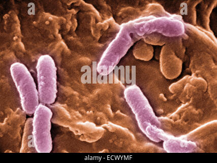 Micrografia elettronica a scansione di Pseudomonas aeruginosa. Foto Stock