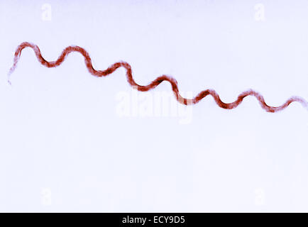 Treponema pallidum mostrato in campo scuro microscopia ottica. Foto Stock