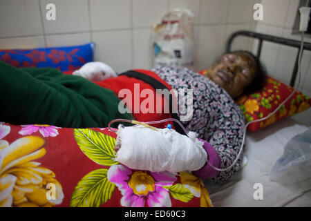 Shamsunnahar iniziata 50 un insegnante della scuola in unità di masterizzazione di Dhaka Medical College Hospital.ella e i suoi due bambini sono stati feriti come miscredenti appiccato il fuoco alle loro CNG-run auto-rickshaw versando benzina a Kazipara a Dhaka questa sera davanti alla BNP-led 20-partito dell'alleanza hartal. Bangladesh attivisti dell'opposizione si sono scontrati con la polizia durante uno sciopero nazionale, lasciando una donna morti e diversi feriti come tensione crebbe nel volatile dal punto di vista politico il paese alla vigilia del primo anniversario di una controversa elezione Foto Stock